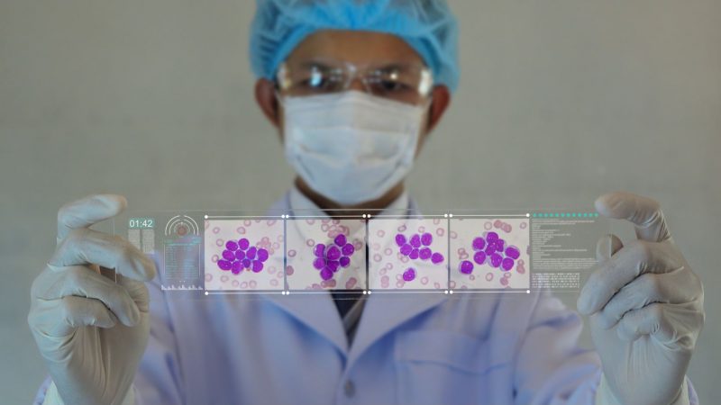 MSP habilitó innovador tratamiento de inmunoterapia para la Leucemia Linfoblástica Aguda