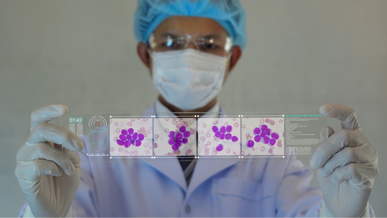 MSP habilitó innovador tratamiento de inmunoterapia para la Leucemia Linfoblástica Aguda